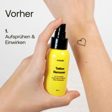 Tattoo Remover zur schonenden Entfernung von Rückständen